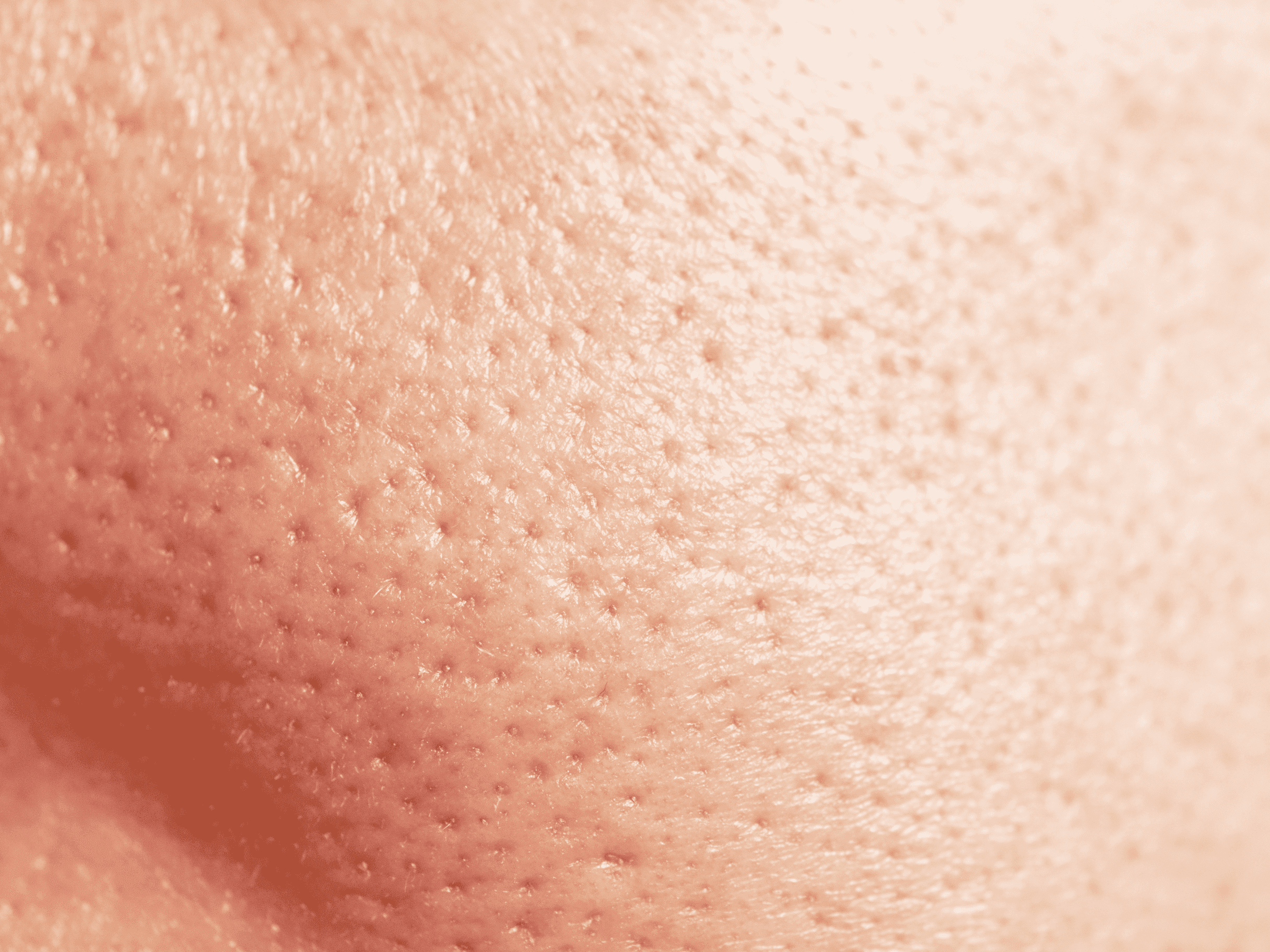 Protocollo per pelle asfittica skincare per pelli impure