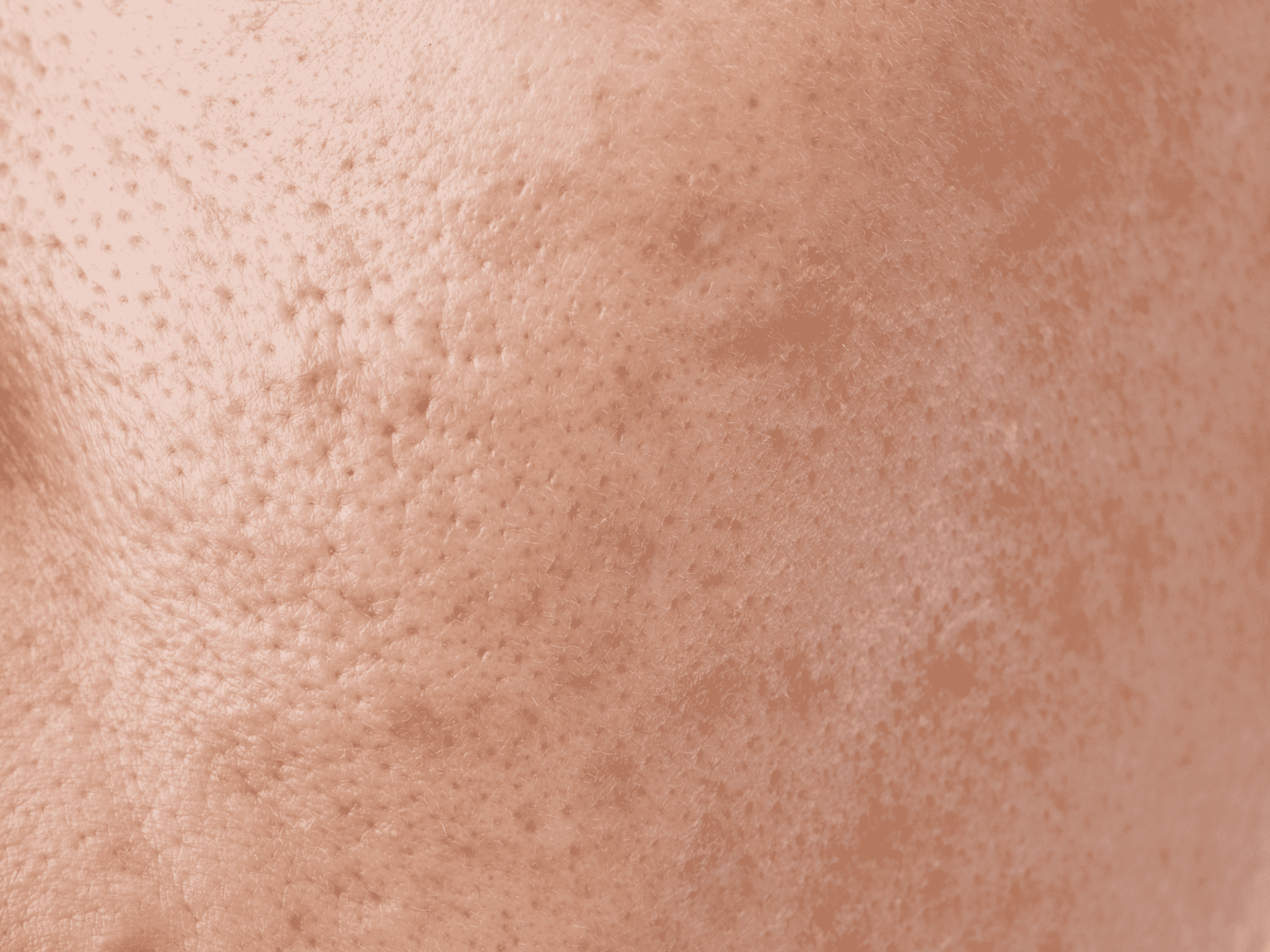 Protocollo per pelle mista skincare per pelli miste