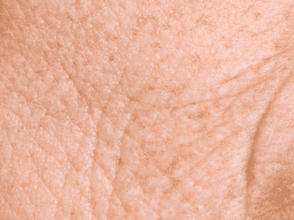Protocollo per pelle segnata con rughe skincare per pelli con rughe