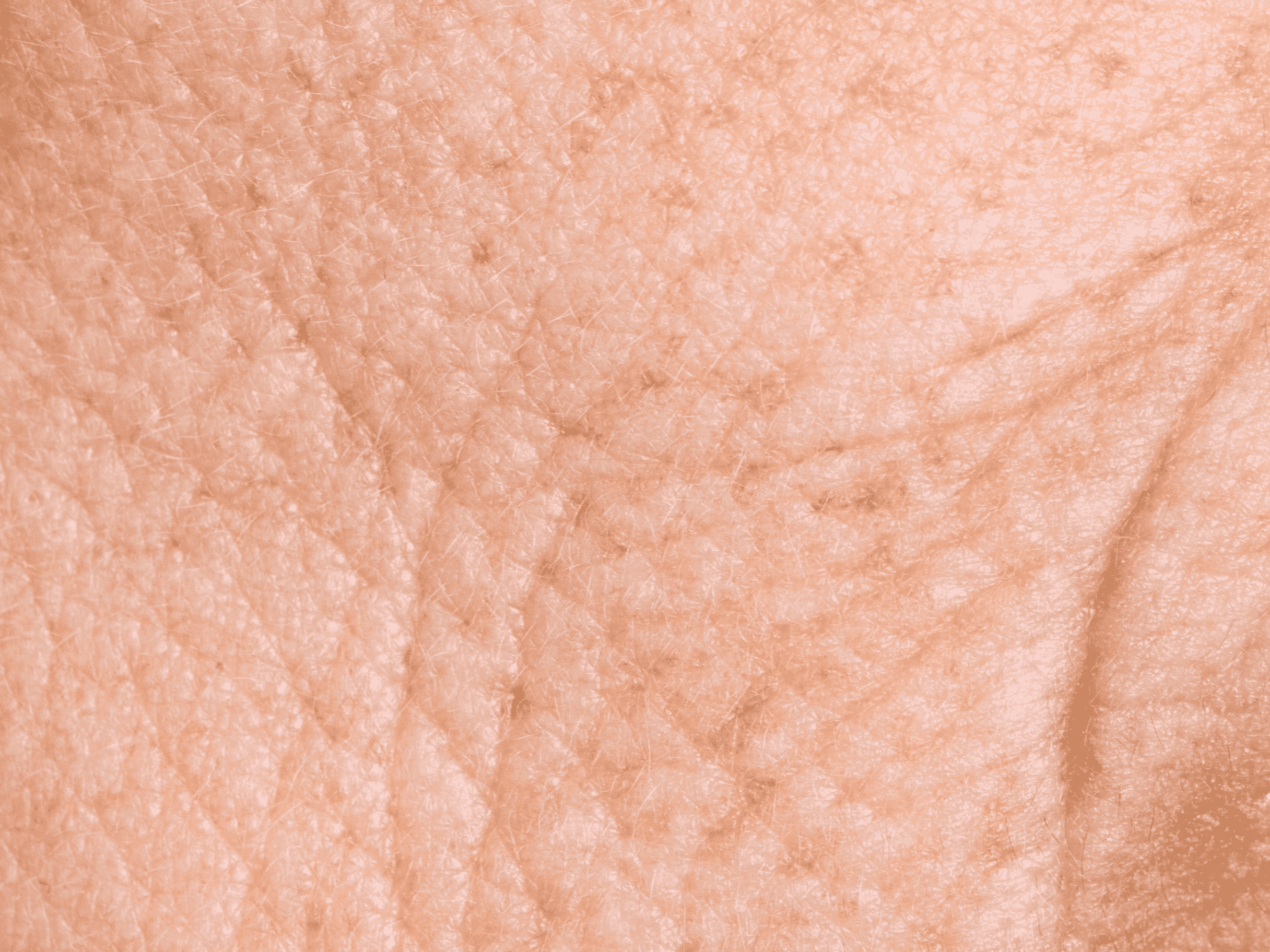 Protocollo per pelle segnata con rughe skincare per pelli con rughe