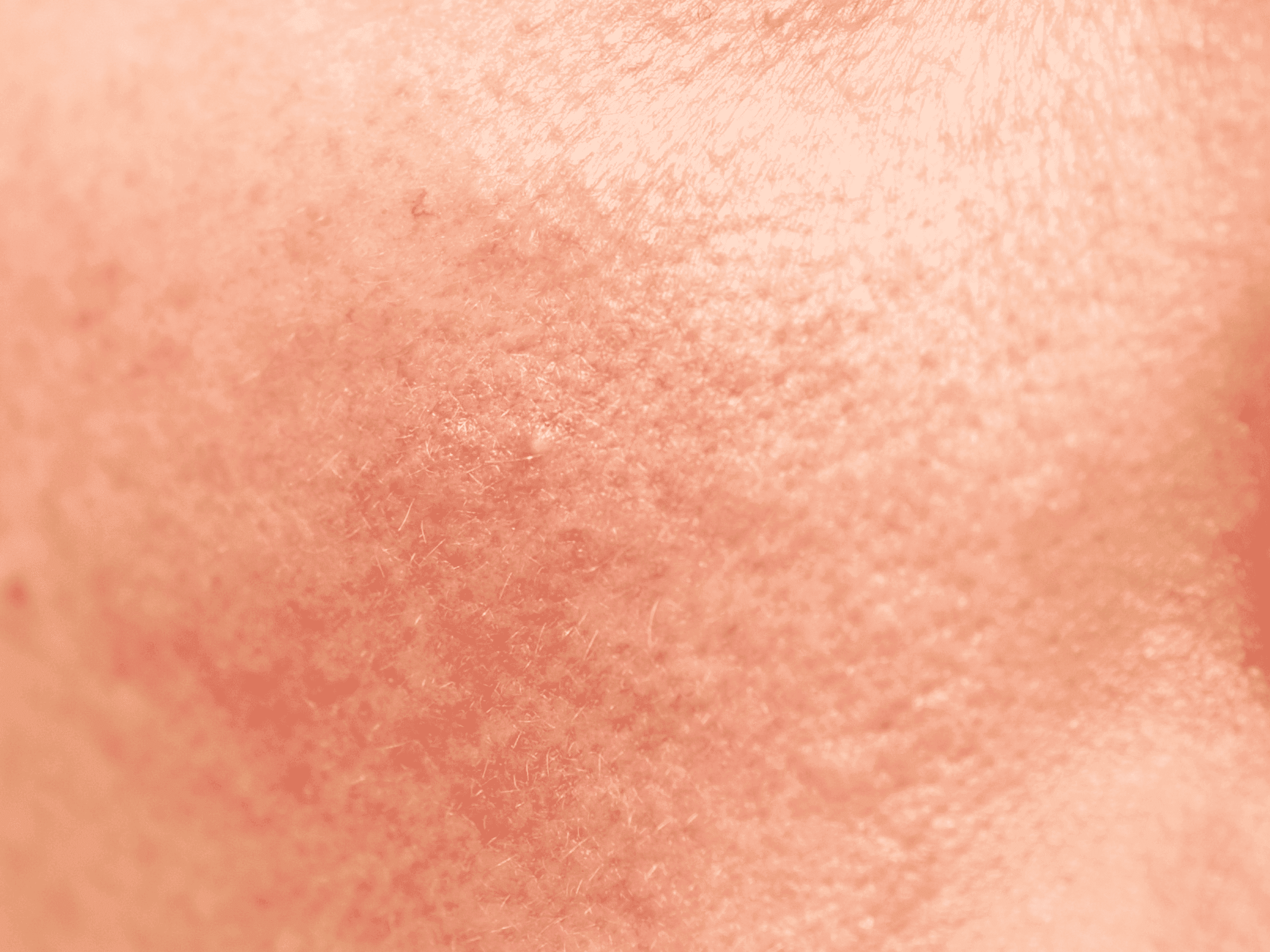 Protocollo per pelle sensibile skincare per pelli sensibili